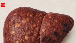 Late night binging, poor sleep, long sitting? A liver warning for young Indians. Delhi News