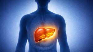 Can fatty liver be undone? This case suggests it can