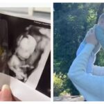 Can a tiny needle save a life before birth? The untold story of Britain’s youngest blood donor recipient