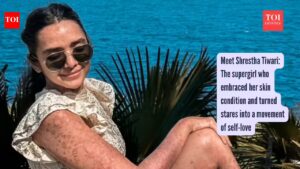 Meet Shrestha Tiwari: The supergirl who embraced her skin condition and turned stares into a movement of self-love |