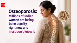 Osteoporosis: Millions of Indian women are losing bone density right now and most don’t know it