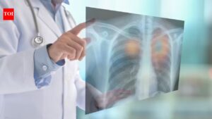 Lung Cancer: Misdiagnosed as TB, this 28-year-old had lung cancer: The one pill that turned his life around