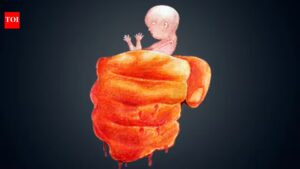 ‘Killers’ of the womb: A son obsession | Delhi News