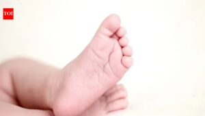 Tanzanian baby with rare skull deformity gets new lease of life in Delhi. Delhi News