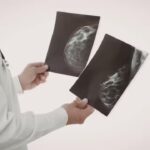 Mammograms are helping docs spot heart disease risk early