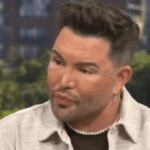 Bobby Norris Explores More Cosmetic Surgery After Facelift at 39 |