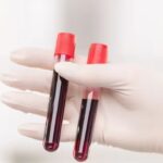 World’s rarest hybrid blood type discovered in Thailand: Study found in just 3 people out of a massive research of 544,000 samples. world news
