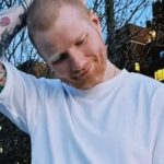 Shingles Treatment: Ed Sheeran reveals shingles diagnosis: What it is and why you should care