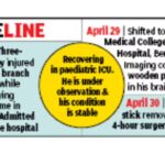 MKCG docs remove 8cm twig from 3-yr-old’s brain | Bhubaneswar News