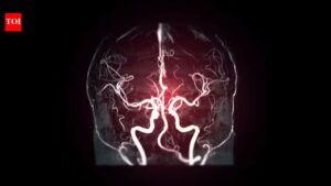Cerebral Angiography: 7 silent warning signs that may mean you need a Cerebral Angiography