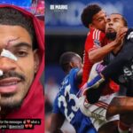 Horror on the pitch: Nottingham Forest star posts gruesome head injury after Chelsea win | football news
