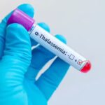 Silent Thalassemia carriers: Doctor explains hidden genetic risk many Indians don’t know about.