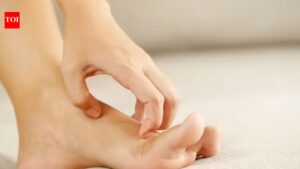 Skin Infections: Summer fungal infections are rising: Dermatologist shares the everyday habits that may be making them worse