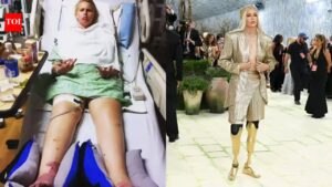 Met Gala 2026: Meet Lauren Wasser: The ‘Girl with Golden Legs’ who lost both her limbs due to a tampon